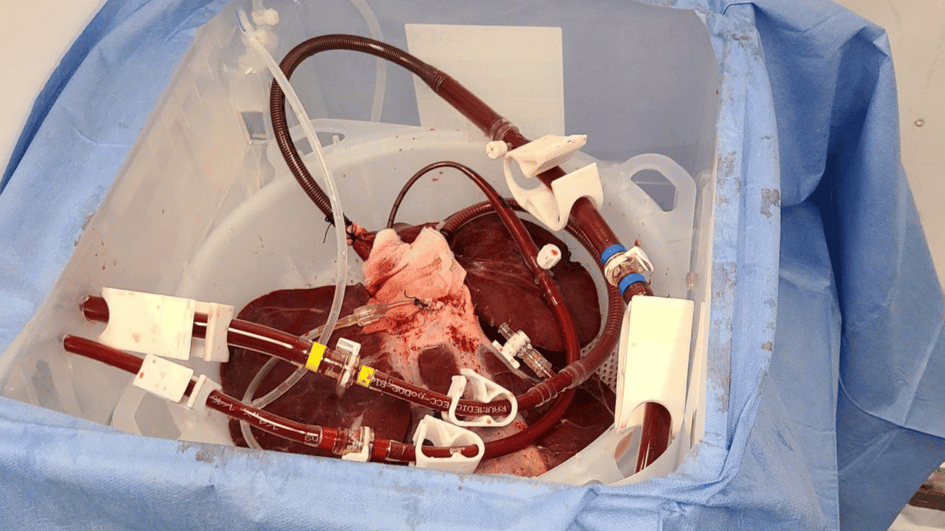 Een allereerste experiment toont aan dat varkens leverfalen kunnen helpen voorkomen