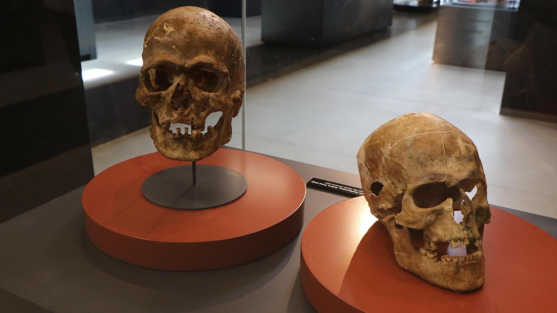 Littekens op een 5000 jaar oude schedel tonen eeuwenoude techniek in het Samsun Museum